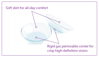 How to Care For Your Synergeyes Contact Lenses